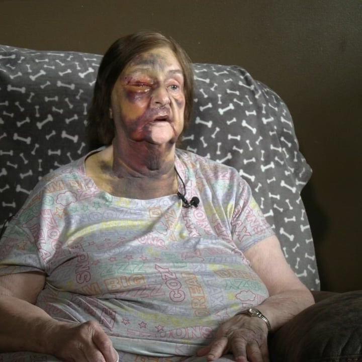 Nelson County woman brutally attacked, 19-year-old facing charges